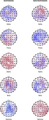 Estimated EEG functional connectivity and aperiodic component induced by vagal nerve stimulation in patients with drug-resistant epilepsy